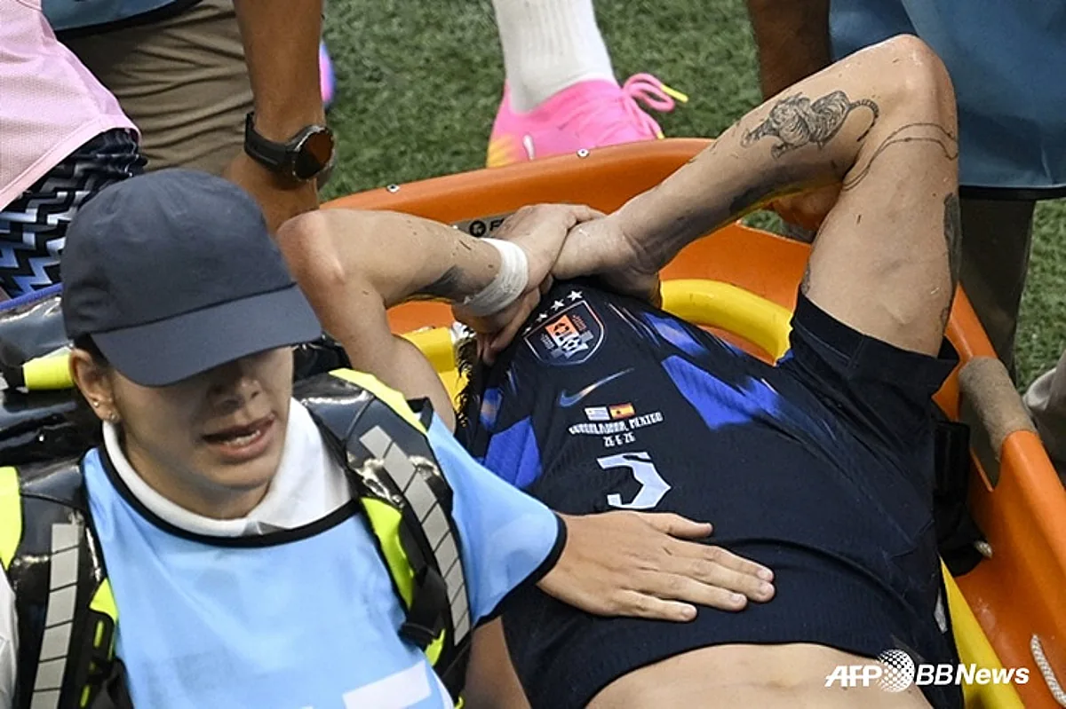Man Utd Midfielder’s World Cup Exit on Stretcher Sparks Transfer Fears - Sports Illustrated
